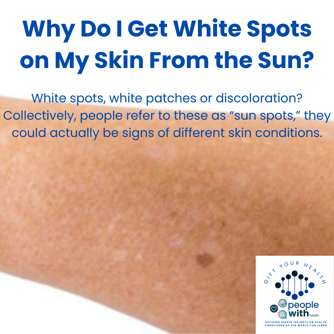 PeopleWith News Why Do I Get White Spots On My Skin From The Sun 